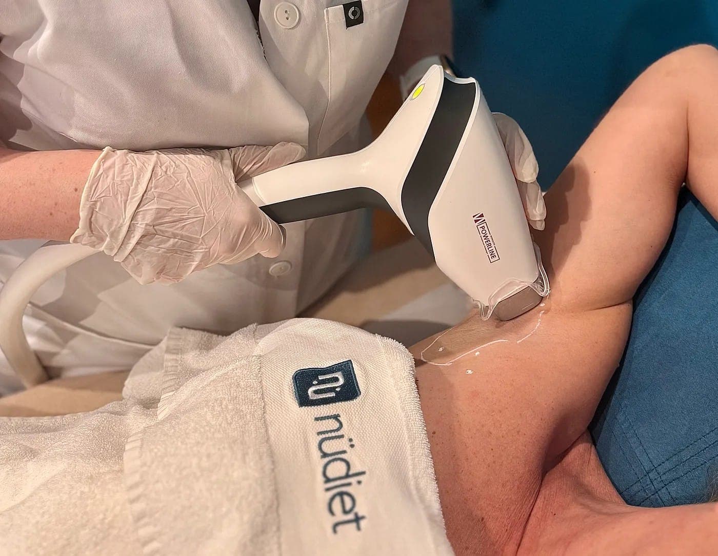 Tout savoir sur l’épilation laser : votre guide complet avec Nüdiet